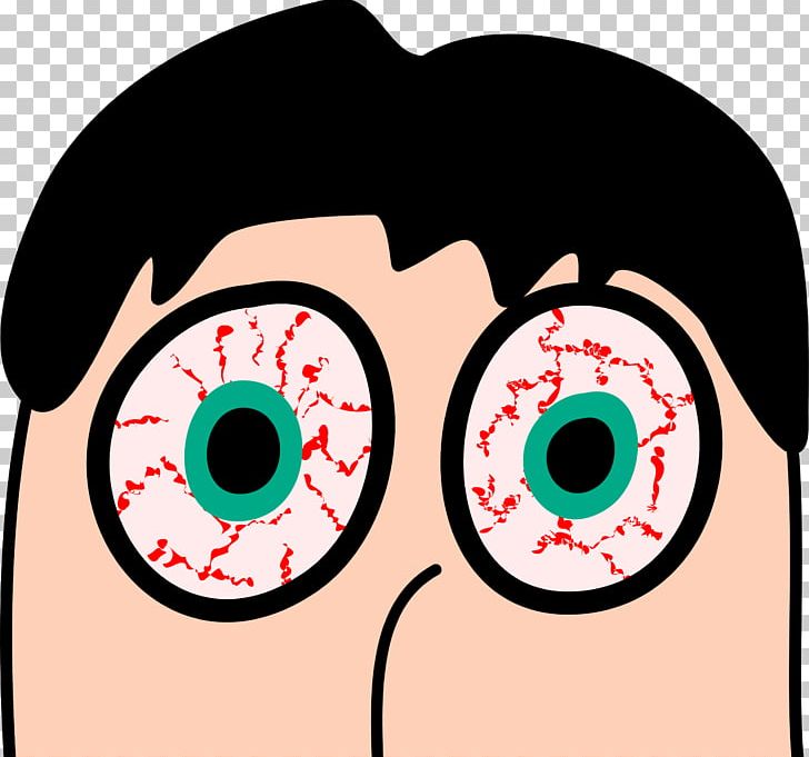 Dry Eye Syndrome Red Eye Eye Strain PNG, Clipart, Art, Cartoon, Cheek, Circle, Conjunctiva Free PNG Download