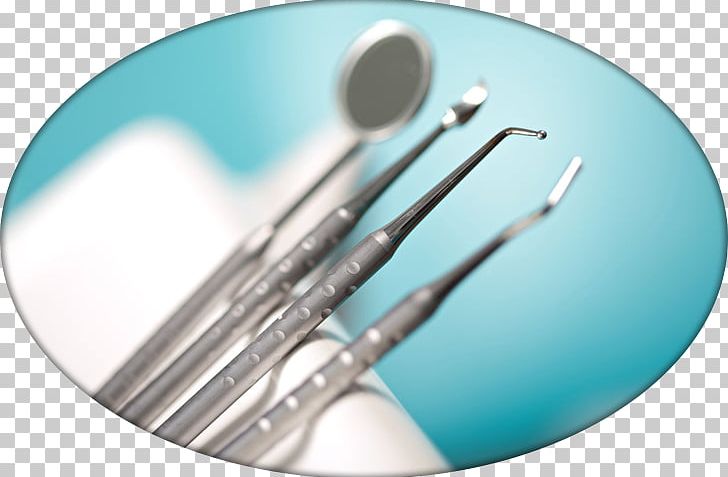 Cosmetic Dentistry Dental Surgery Dental Implant PNG, Clipart, Bridge, Cosmetic Dentistry, Cutlery, Dental, Dental Implant Free PNG Download