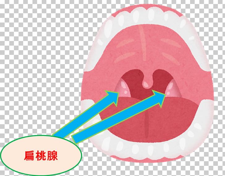 Mouth Tonsil Throat Pharynx Therapy PNG, Clipart, Bad Breath, Digestion, Disease, Eating, Jaw Free PNG Download