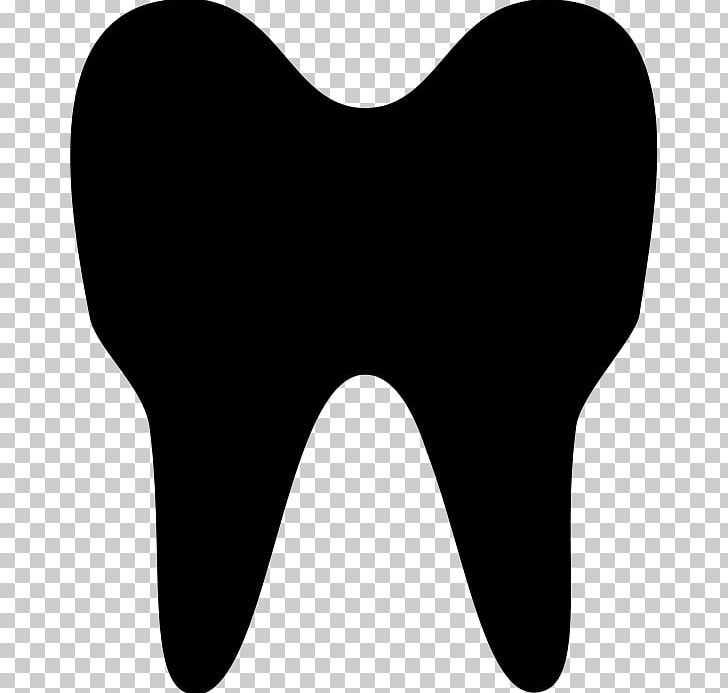 Dentistry Human Tooth PNG, Clipart, Black And White, Computer Icons, Dentist, Dentistry, Dentures Free PNG Download