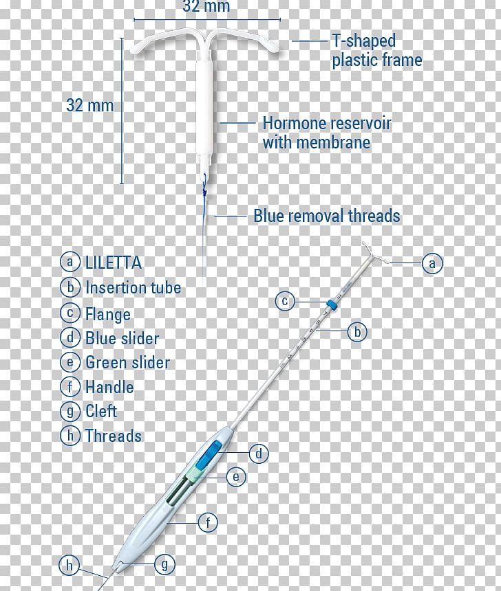 Progestin IUD Intrauterine Device Levonorgestrel Birth Control Liletta PNG, Clipart, Adverse Effect, Angle, Birth Control, Caesarean Section, Childbirth Free PNG Download