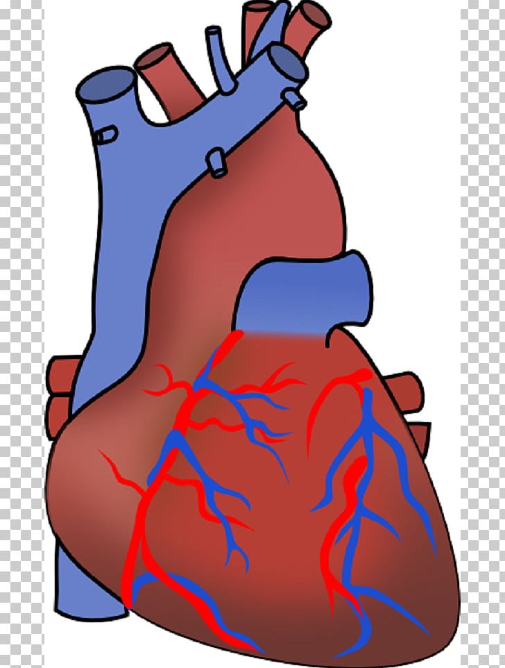 Myocardial Infarction Heart Failure Cardiovascular Disease PNG, Clipart, Arm, Art, Cardiac Surgery, Cardiovascular Disease, Cartoon Free PNG Download