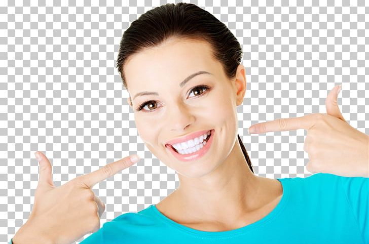 Tooth Whitening Human Tooth Cosmetic Dentistry Smile PNG, Clipart, Arm, Bridge, Chin, Crown, Dental Implant Free PNG Download
