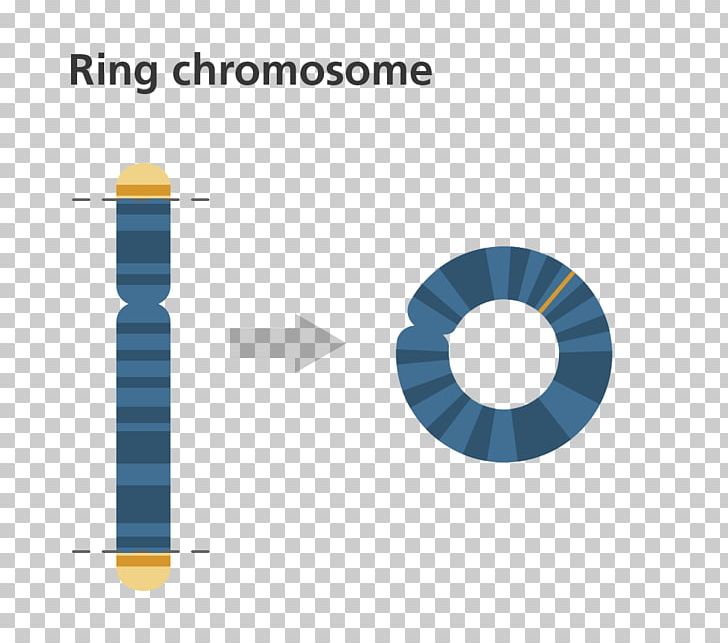 Ring Chromosome 14 Syndrome Chromosome Abnormality Genetics PNG, Clipart, Abnormality, Angle, Brand, Chromosome, Chromosome Abnormality Free PNG Download
