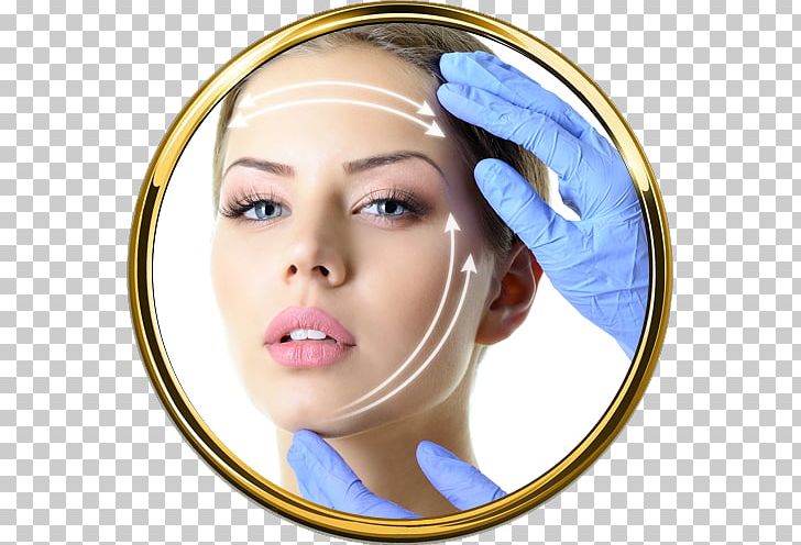 Rhytidectomy Plastic Surgery Aesthetic Medicine PNG, Clipart, Aesthetic Medicine, Botulinum Toxin, Cheek, Chin, Cosmetics Free PNG Download