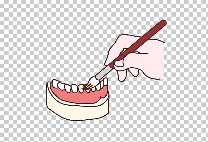 Tooth Dental Technician Dentures Dentistry PNG, Clipart, Brush, Dental Implant, Dental Technician, Dentist, Dentistry Free PNG Download