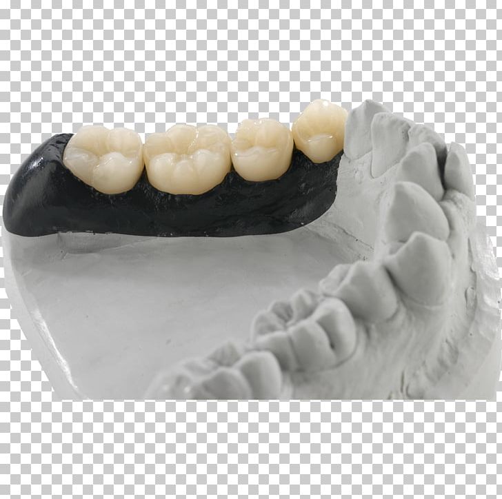 Dentist Dental Technician Dental Laboratory Anatomická Pinzeta Zahntechnik PNG, Clipart, Computeraided Design, Dental Laboratory, Dental Technician, Dentist, Jaw Free PNG Download