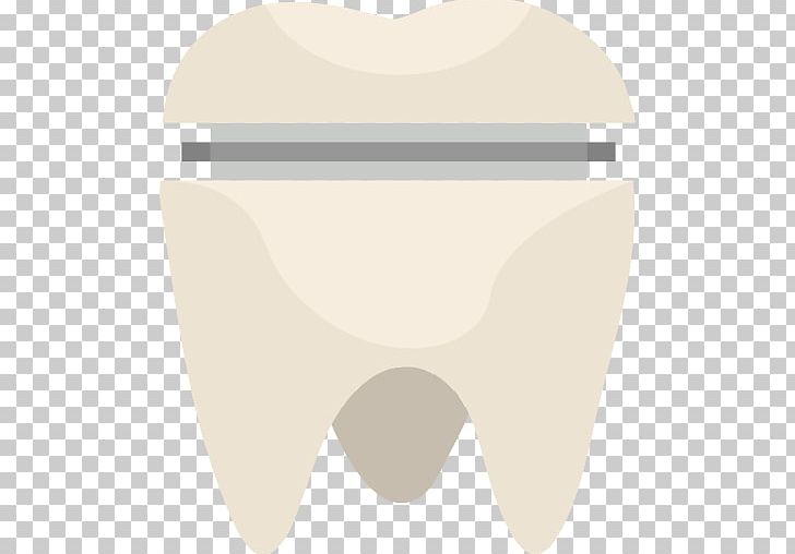 Tooth Dentistry Molar Crown PNG, Clipart, Angle, Crown, Dental, Dental Abscess, Dental Surgery Free PNG Download