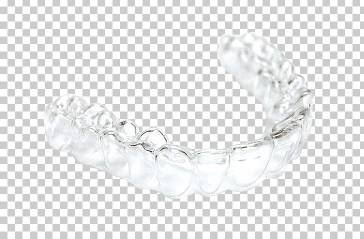 Clear Aligners Dentistry Orthodontics Retainer PNG, Clipart, Body Jewelry, Bracelet, Cosmetic Dentistry, Dental Braces, Dental Implant Free PNG Download