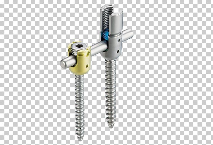Institute For Composite Materials Ulrich GmbH & Co. KG Implant Vertebral Column Ulrich Medical USA PNG, Clipart, Angle, Cylinder, Hardware, Hardware Accessory, Implant Free PNG Download