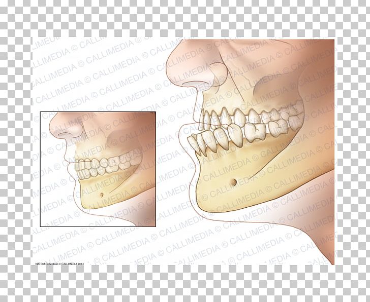 Acromegaly Prognathism Jaw Endocrinology Growth Hormone PNG, Clipart, Acromegaly, Anabolika, Caution, Endocrinology, Finger Free PNG Download