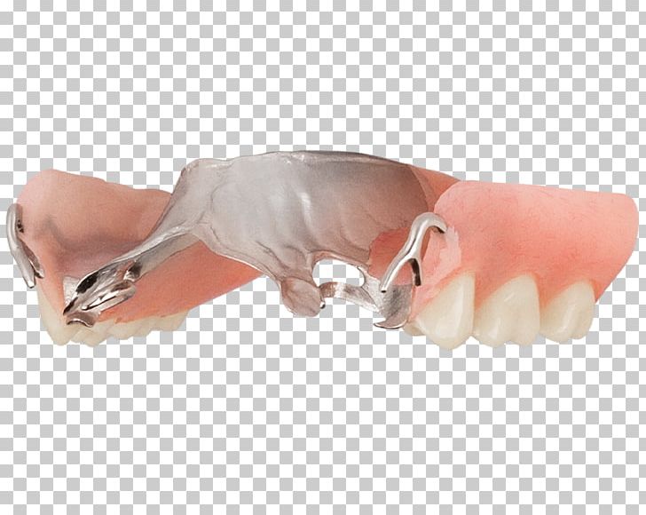Nail Thumb Snout Tooth PNG, Clipart, Arrow, Cold, Finger, Hand, Jaw Free PNG Download