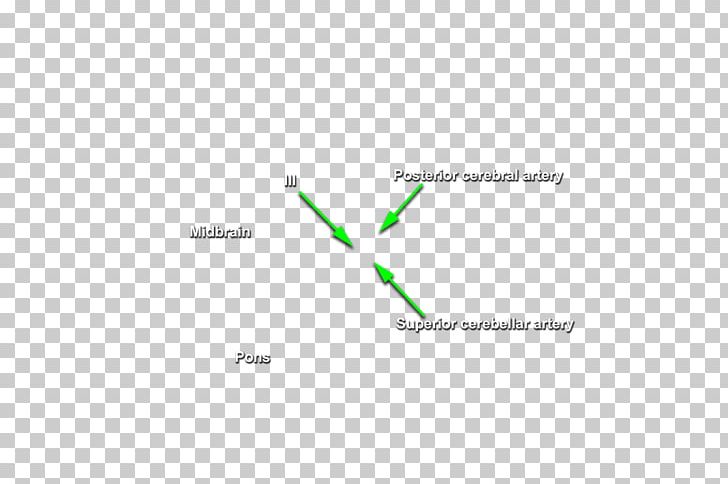 Brand Line Diagram PNG, Clipart, Angle, Area, Art, Brand, Diagram Free PNG Download