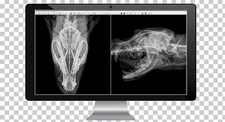 Medical Imaging Radiology Medicine X-ray Radiography PNG, Clipart, Bone, Computer Wallpaper, Dental Radiography, Dentistry, Digital Free PNG Download