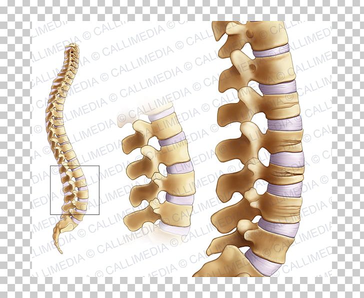 Bone Fracture Joint Osteoporosis Femoral Neck Rheumatology PNG, Clipart, Bone, Bone Fracture, Carpal Bones, Female, Femoral Neck Free PNG Download