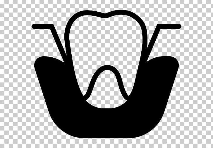 Dentistry Dental Extraction Computer Icons Encapsulated PostScript PNG, Clipart, Black, Black And White, Computer Icons, Dental Extraction, Dentist Free PNG Download