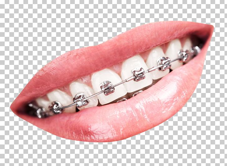 dental png