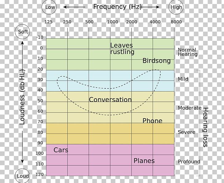 Hearing Loss Hearing Range Hearing Test Audiogram PNG, Clipart, Angle, Area, Audio Frequency, Audiogram, Audiology Free PNG Download