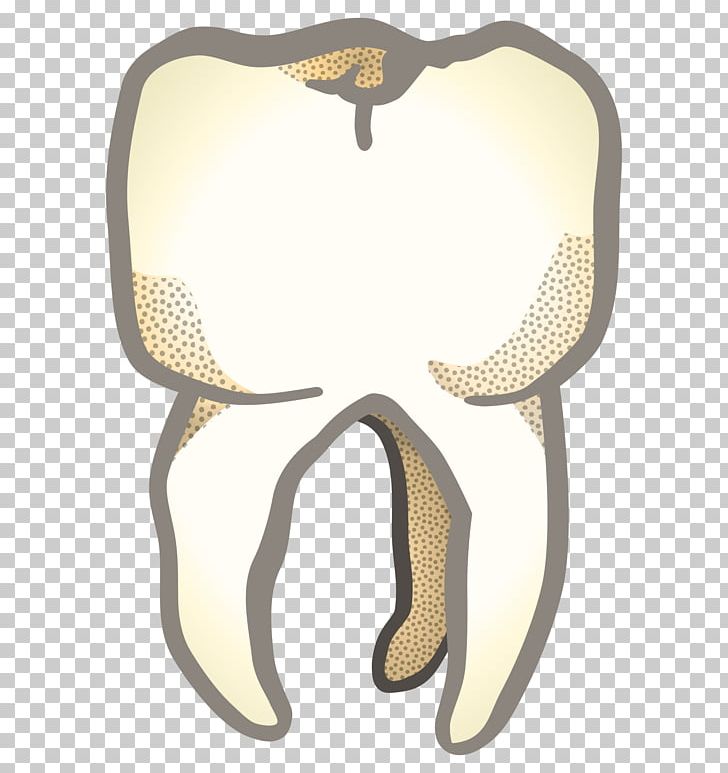 Tooth Jaw PNG, Clipart, Animals, Computer Icons, Drawing, Face, Jaw Free PNG Download