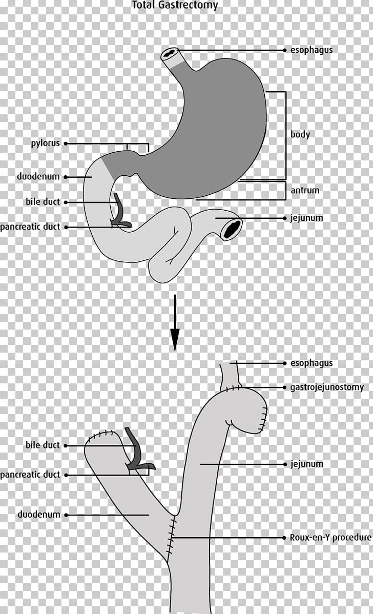 Finger Mammal Shoe Technology PNG, Clipart, Angle, Area, Arm, Art, Black And White Free PNG Download
