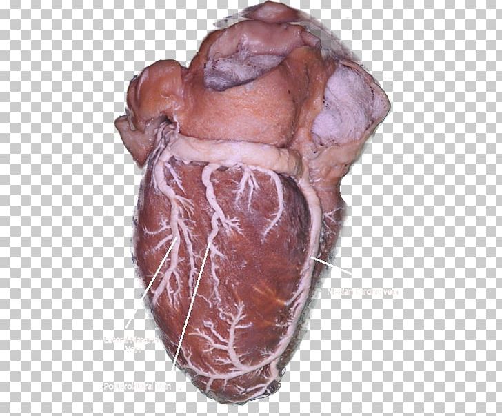 Small Cardiac Vein Heart Coronary Sinus Great Cardiac Vein PNG, Clipart,  Free PNG Download