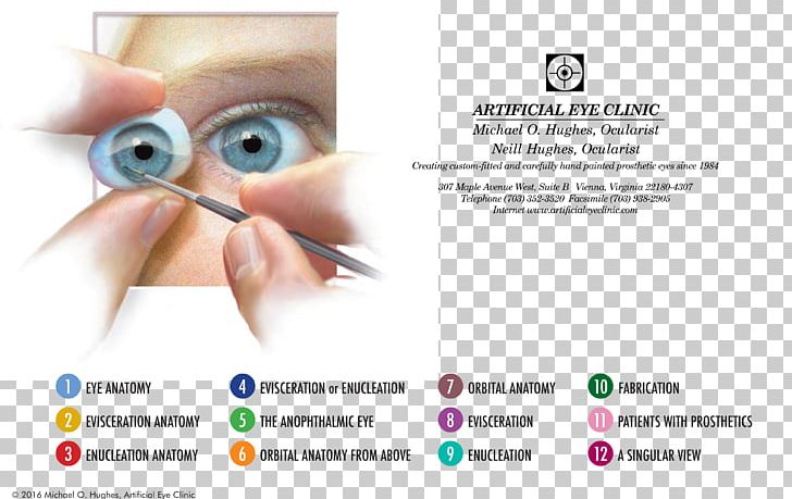 Human Eye Ocular Prosthesis Ocularist Eye Care Professional PNG, Clipart, Corneal Limbus, Ear, Eye, Eye Care Professional, Eyelash Free PNG Download