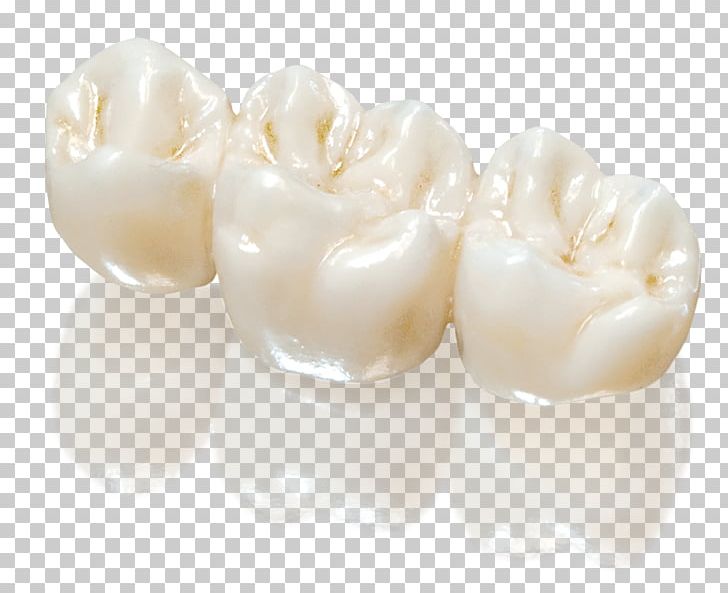 Crown Zirconium Dioxide Dental Laboratory Dentistry Material PNG, Clipart, Abutment, Bridge, Crown, Cubic Zirconia, Dental Implant Free PNG Download