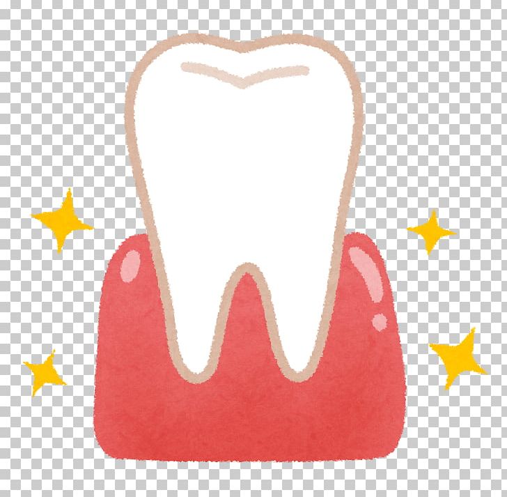Tooth 歯科 Gums Dentist Periodontal Disease PNG, Clipart, Alveolar Process, Cambra, Dental Calculus, Dental Hygienist, Dental Plaque Free PNG Download