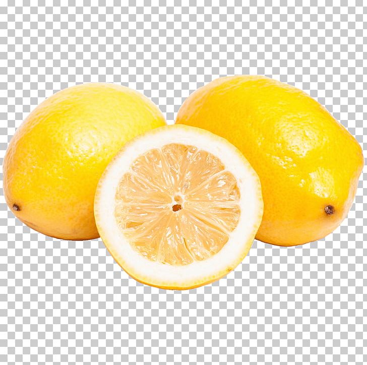 Sweet Lemon Citron Citrus Junos Grapefruit PNG, Clipart, Acid, Birne, Citric Acid, Citron, Citrus Free PNG Download