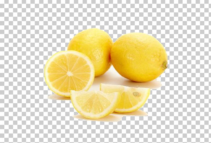 Sweet Lemon Citron Citrus Junos Lemon-lime Drink PNG, Clipart, Citric Acid, Citrus, Encapsulated Postscript, Food, Free Logo Design Template Free PNG Download