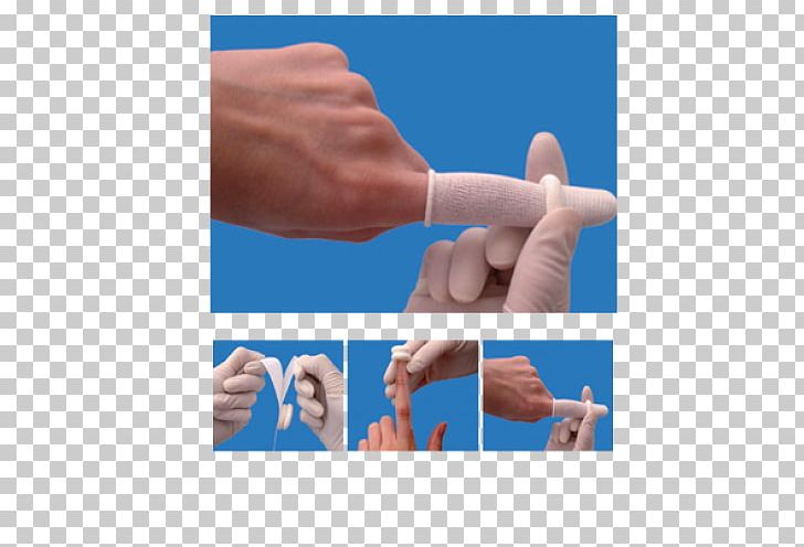 Thumb Dressing Digit Adhesive Bandage Finger Cot PNG, Clipart, Adhesive Bandage, Alginate Dressing, Alginic Acid, Arm, Bandage Free PNG Download