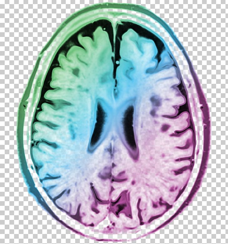 Computed Tomography Brain Organism PNG, Clipart, Brain, Computed Tomography, Jaw, Medical, Medical Imaging Free PNG Download