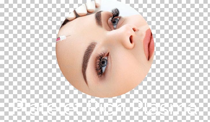 Platelet-rich Plasma Therapy Surgery Facial Rejuvenation PNG, Clipart, Beauty, Blood, Blood Plasma, Botulinum Toxin, Cheek Free PNG Download