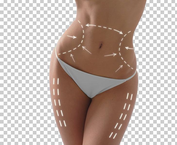 Body Contouring Cryolipolysis Non-surgical Liposuction Surgery PNG, Clipart, Abdomen, Abdominal Obesity, Active Undergarment, Adipose Tissue, Aesthetic Medicine Free PNG Download