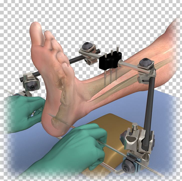 Finger Medical Animation Medical Glove PNG, Clipart, 3d Computer Graphics, Arm, Brochure, Content Marketing, Finger Free PNG Download