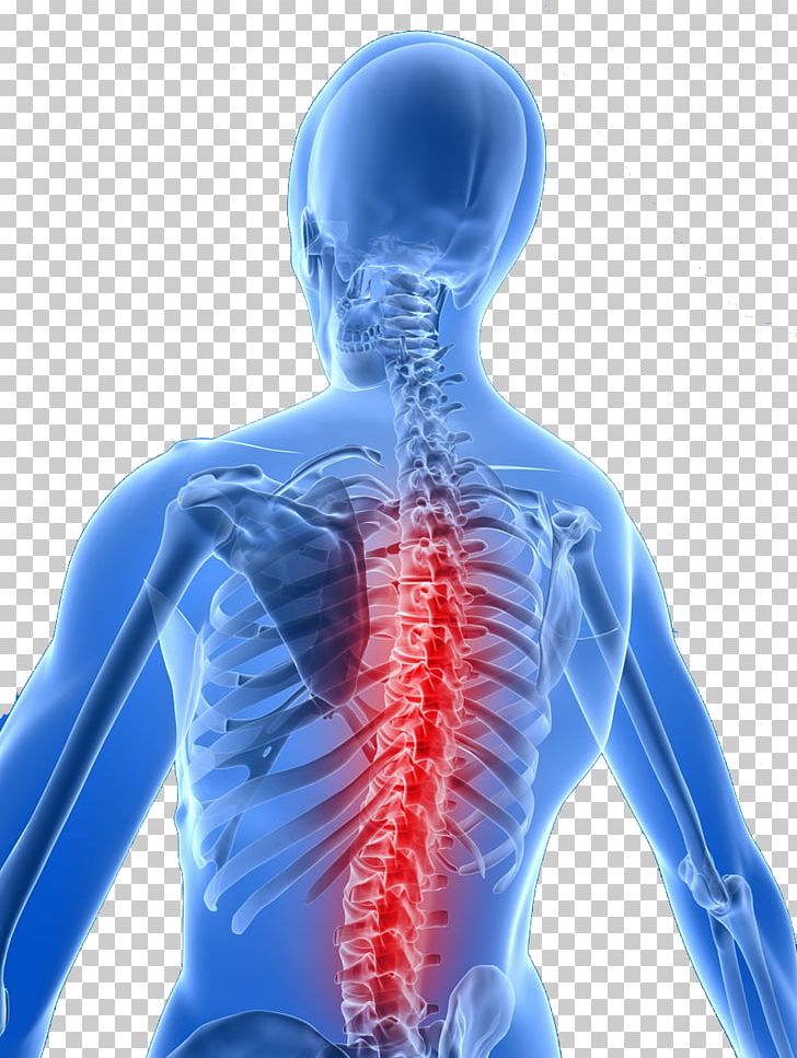 Back Pain Vertebral Column Chiropractic Therapy Health Care PNG, Clipart, Arm, Back, Chiropractor, Electric Blue, Health Free PNG Download