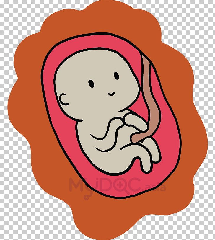 Caesarean Section Surgery Childbirth Fetus PNG, Clipart, Abdomen, Art, Cartoon, Face, Fictional Character Free PNG Download