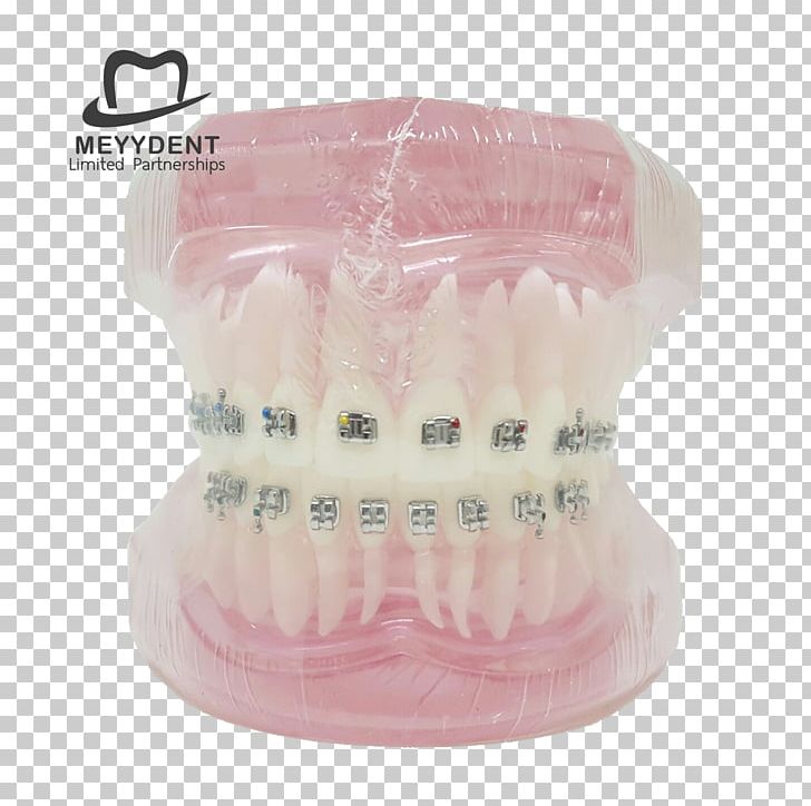 หจก.เมย์เด้นท์ Dentist Jaw Human Tooth PNG, Clipart, 2017, Dental Model, Dentist, Dentistry, Email Free PNG Download