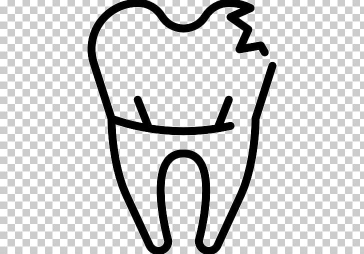 Dentistry Dental Implant Human Tooth PNG, Clipart, Black And White, Clinic, Dental Instruments, Dentistry, Hand Free PNG Download
