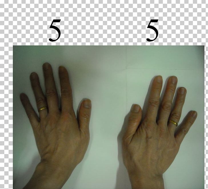 Thumb Hand Model Nail Font PNG, Clipart, Casting Out Nines, Finger, Hand, Hand Model, Nail Free PNG Download