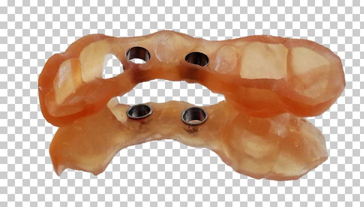 Implantology Surgery Dentist 3D Printing PNG, Clipart, 3d Printing, Animal, Animal Figure, Dentist, Digital Data Free PNG Download