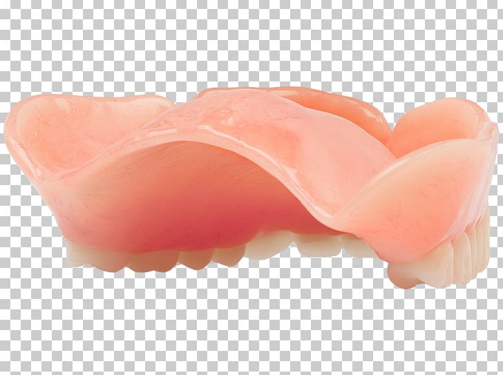 Mouth Dentures PNG, Clipart, Aspen, Aspen Dental, Custom, Dentures, Jaw Free PNG Download