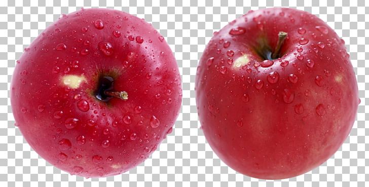 審美歯科 Apple Dentist Food PNG, Clipart, Accessory Fruit, Apple, Dentist, Diet Food, Food Free PNG Download