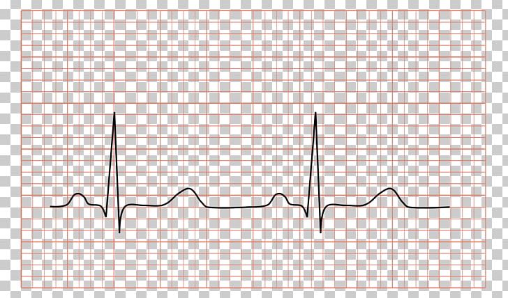 Electrocardiography Heart QRS Complex Sinus Rhythm Sinoatrial Node PNG, Clipart, Angle, Area, Cardiology, Diagram, Electrocardiography Free PNG Download