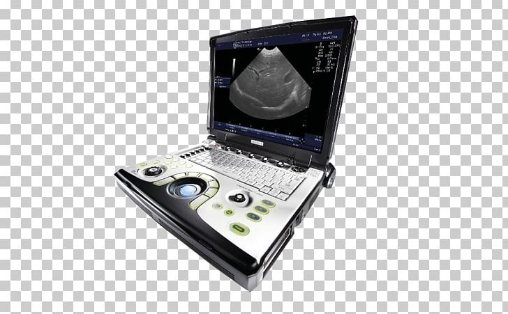 Portable Ultrasound GE Healthcare Voluson 730 Medical Imaging PNG, Clipart, Cardiology, Electronics, Ge Healthcare, General Electric, Hardware Free PNG Download
