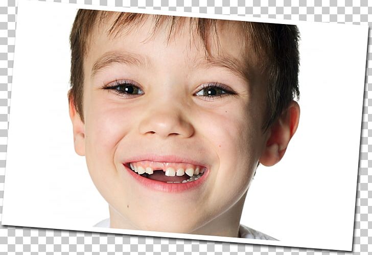 Stock Photography PNG, Clipart, Boy, Cheek, Child, Chin, Closeup Free PNG Download