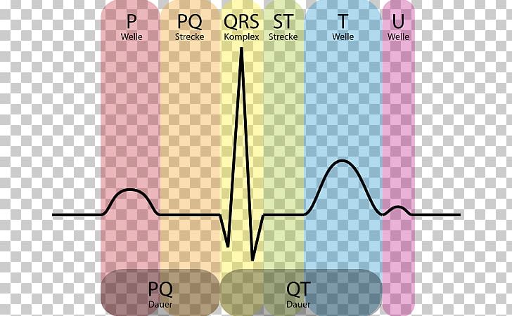 Electrocardiography Heart Cardiology Systole QRS Complex PNG, Clipart, Angle, Artificial Cardiac Pacemaker, Atrial Fibrillation, Cardiac Muscle, Cardiac Pacemaker Free PNG Download