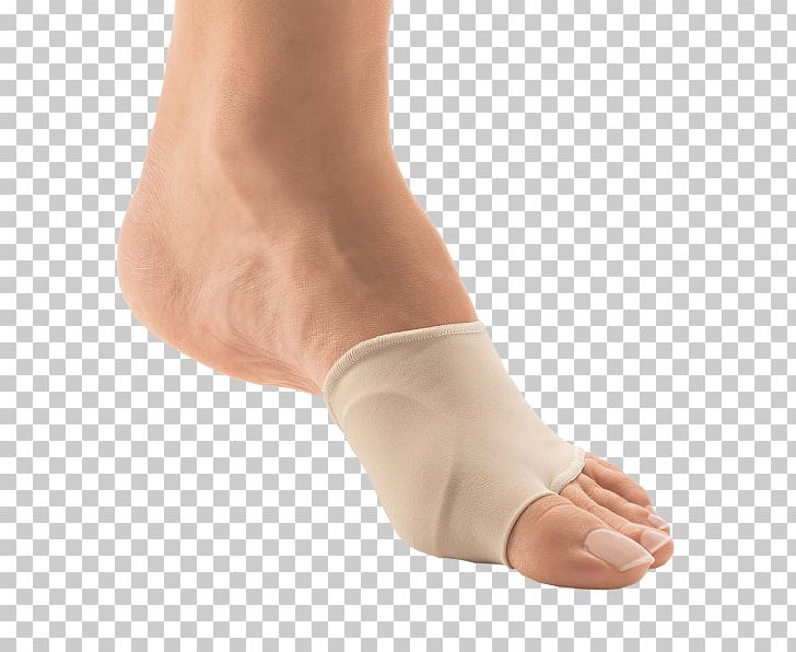 Toe Bunion Foot Hallux Shoe PNG, Clipart, Ankle, Arm, Bandage, Bone Fracture, Bunion Free PNG Download