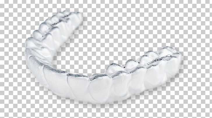 Clear Aligners ClearCorrect Dentistry Orthodontics Dental Braces PNG, Clipart, Align Technology, Body Jewelry, Bracelet, Cadcam Dentistry, Chain Free PNG Download
