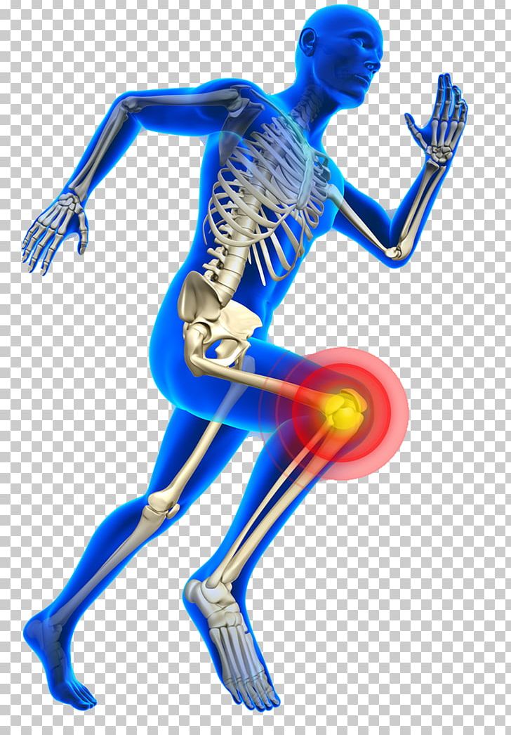 Knee Pain Sports Injury Physical Therapy Sports Medicine PNG, Clipart, Arm, Arthritis, Athlete, Blue, Bone Free PNG Download
